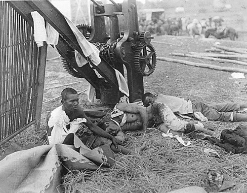 March 29, 1899: Wounded Filipino POWs at Bigaa, Bulacan Province