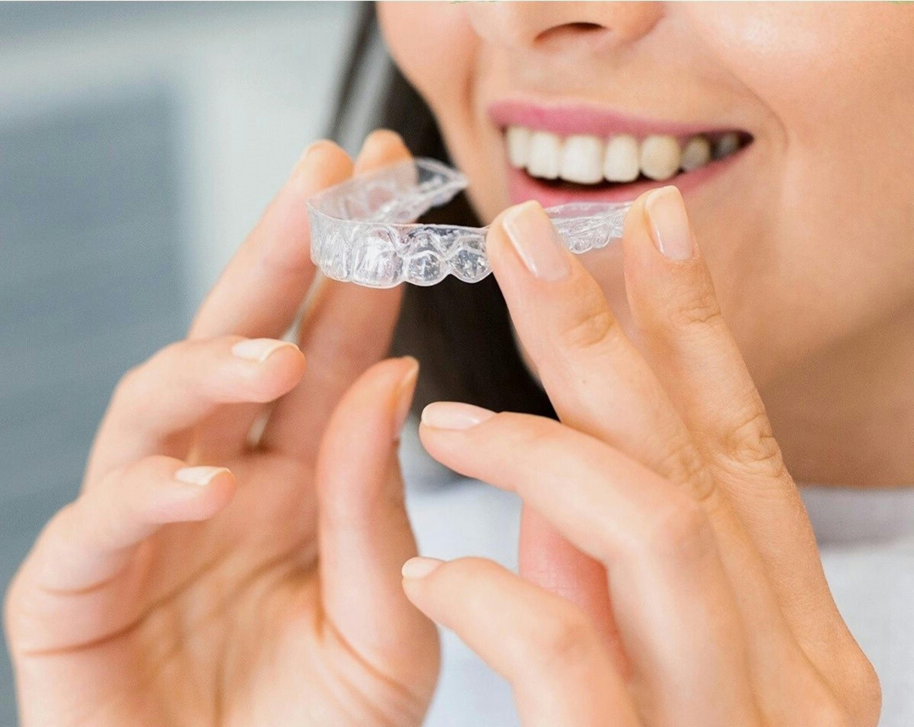 What are the Crucial Benefits of Invisalign