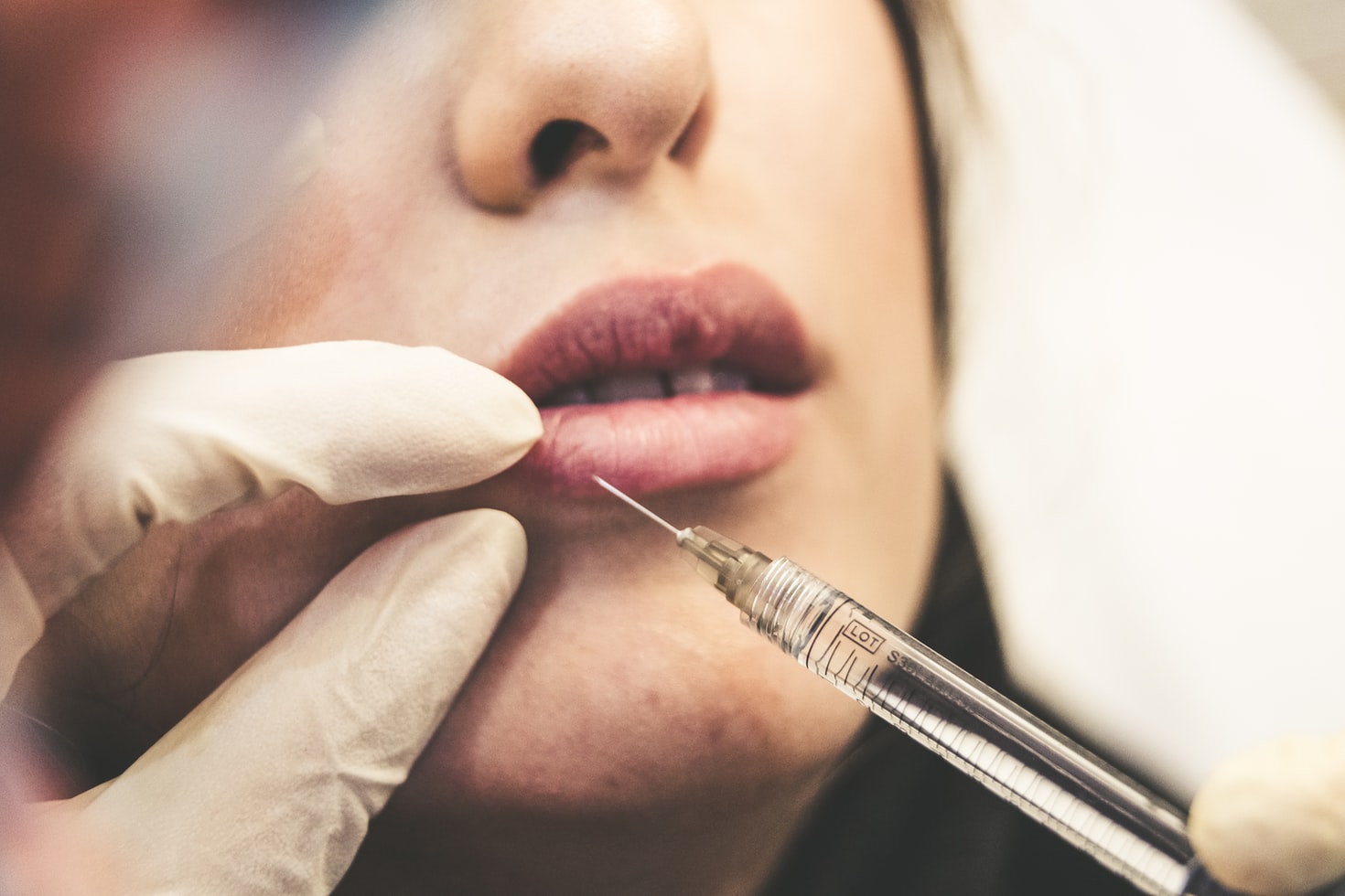 What you need to know about lip filler injections