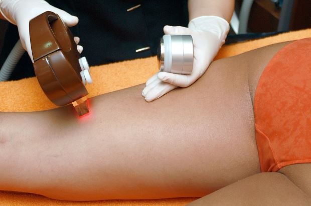 A Beginner’s Guide to Laser Hair Removal